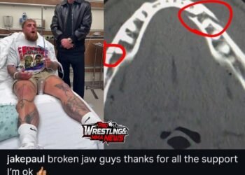 Jake Paul Has Double Broken Jaw!