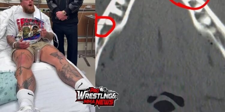 Jake Paul Has Double Broken Jaw!